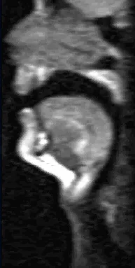 MRI scan showing a side view of a human mouth with Aww vowel shape of tongue